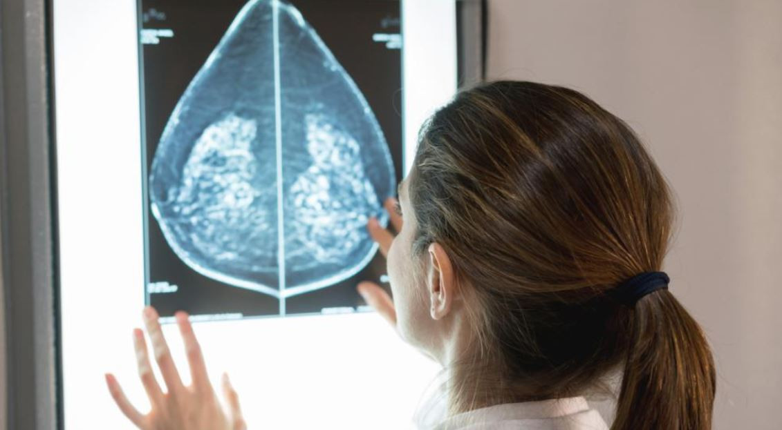 Cribado de cáncer de mama con una imagen obtenida en un mamógrafo