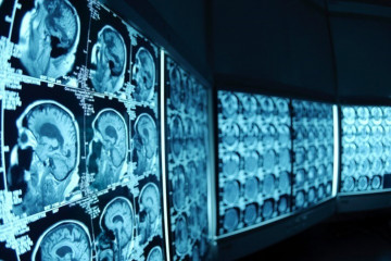 Radiología