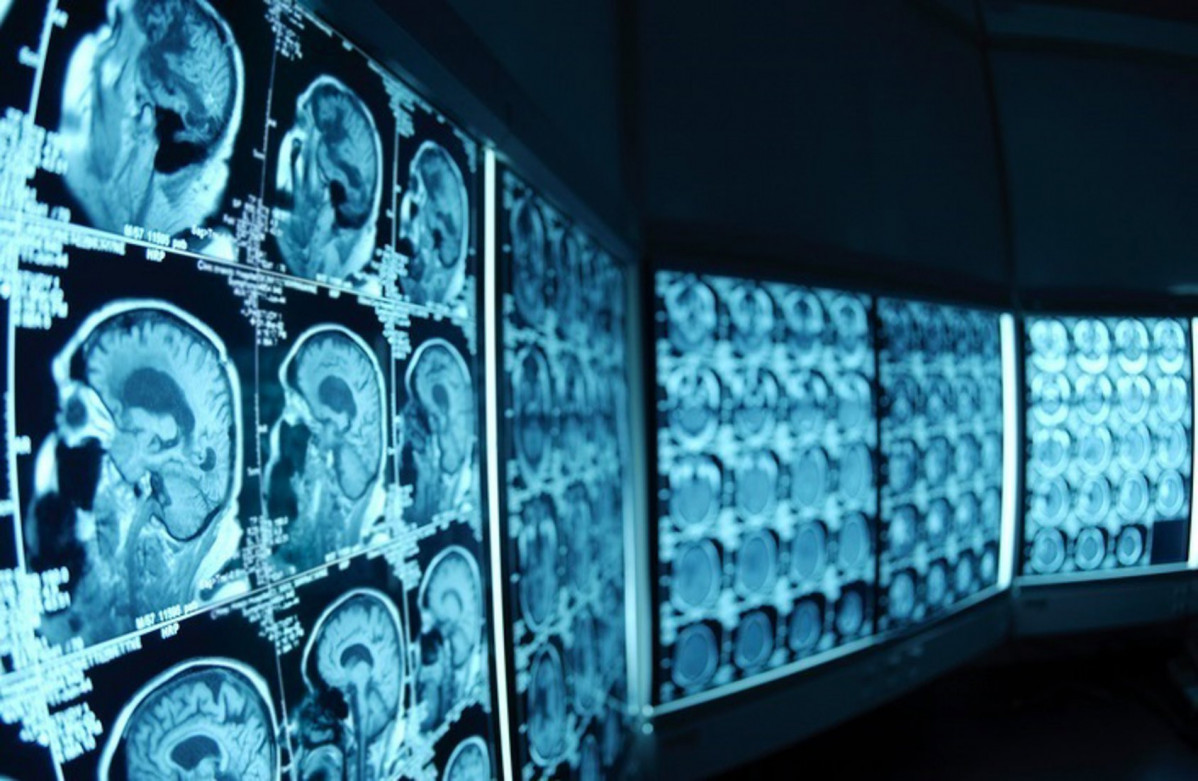 Radiologu00eda