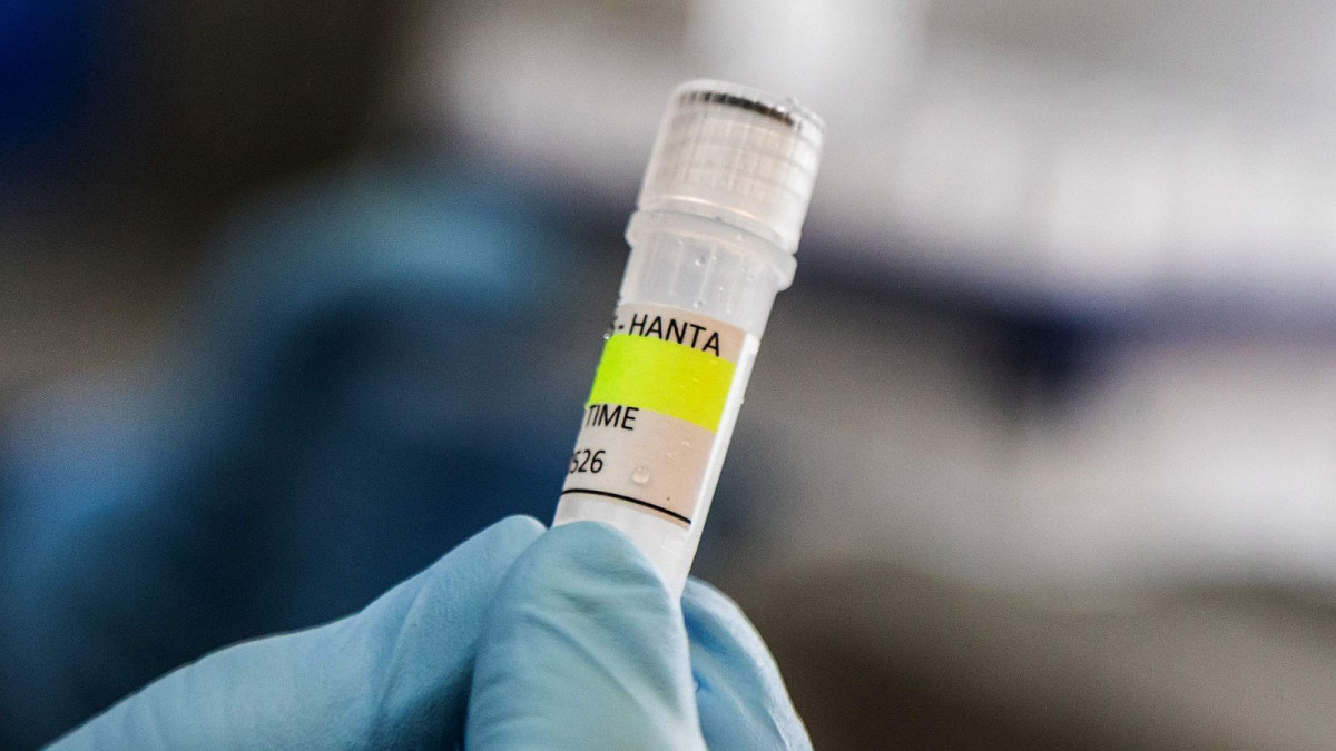 Hantavirus Foto RTVE