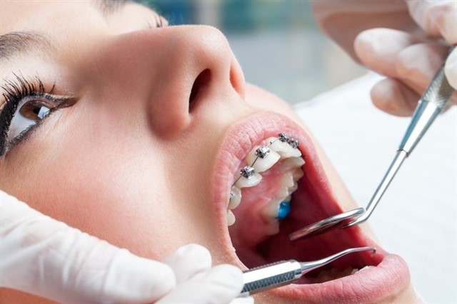 Dentistas dentes