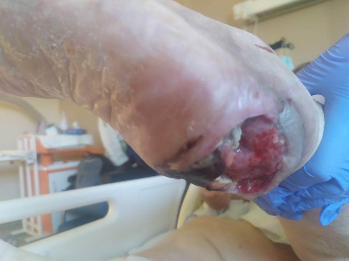 Imaxe dunha ou00falcera no pé da anciá difundida pola súa familia